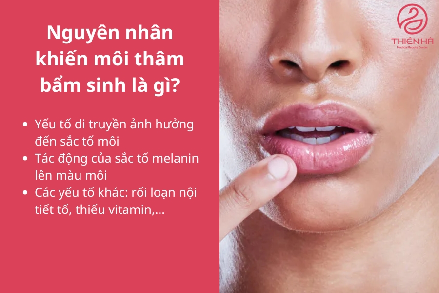 Các nguyên nhân gây môi thâm bẩm sinh