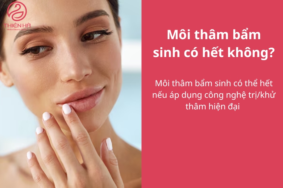 Môi thâm bẩm sinh có thể tự hết