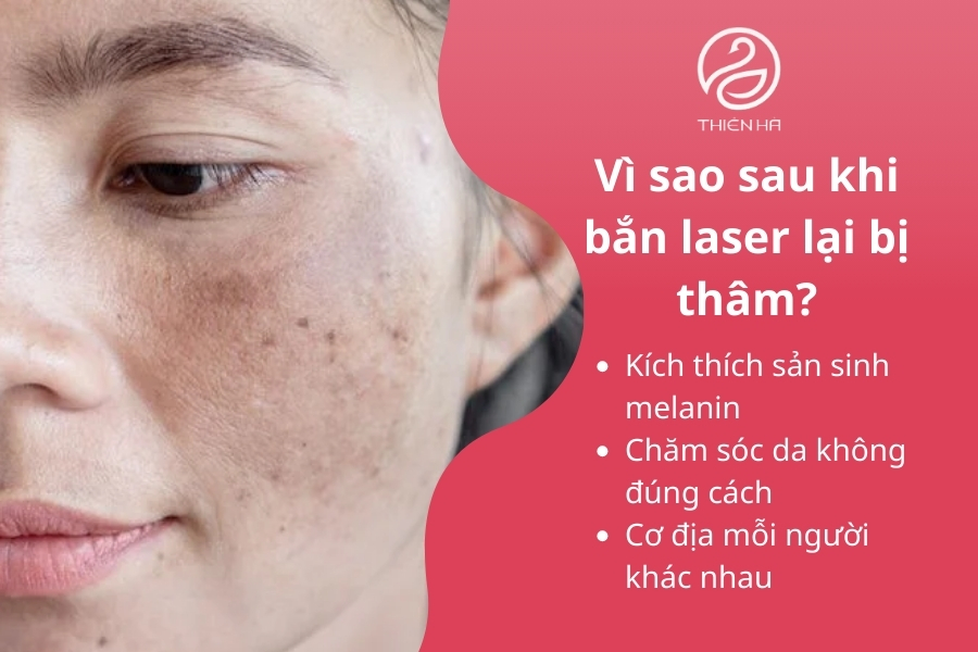 Nguyên nhân da bị thấm sau khi bắn laser