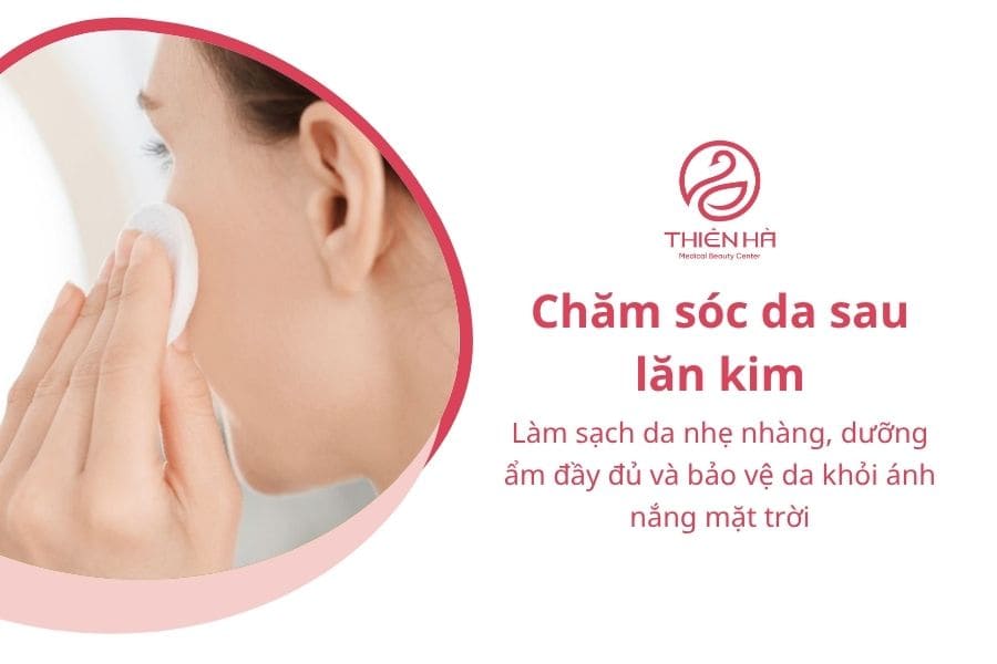 Các bước chăm sóc da sau lăn kim tại nhà