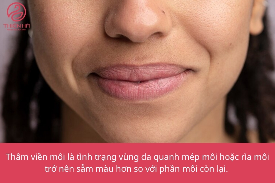 Rất nhiều người đã và đang gặp tình trạng thâm viền môi 