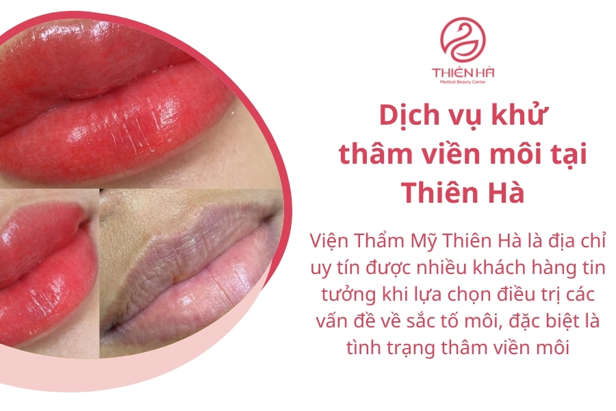 Thiên Hà áp dụng nhiều máy móc hiện đại và công nghệ tiên tiến giúp khách hàng đánh bật viền môi thâm 