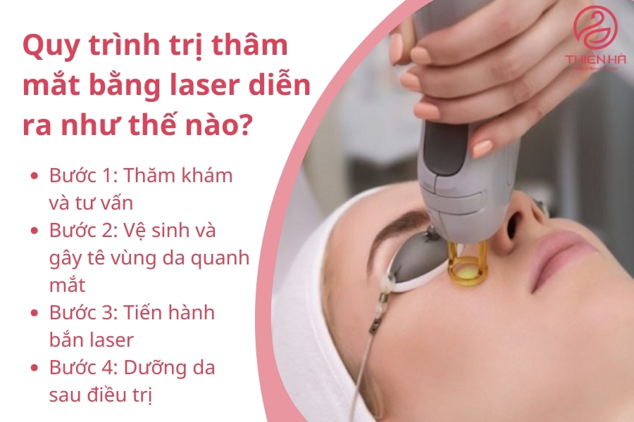 Quy trình 4 bước trị thâm mắt bằng laser 