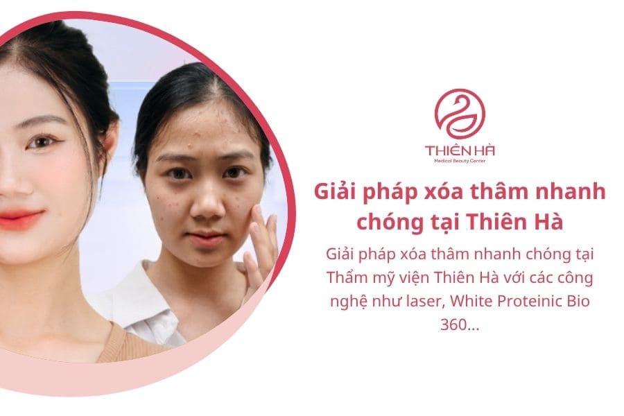 Giải pháp xóa thâm nhanh chóng bằng công nghệ cao tại Thẩm mỹ viện Thiên Hà cho các vết thâm lâu năm, thâm đậm màu hay thâm diện tích lớn