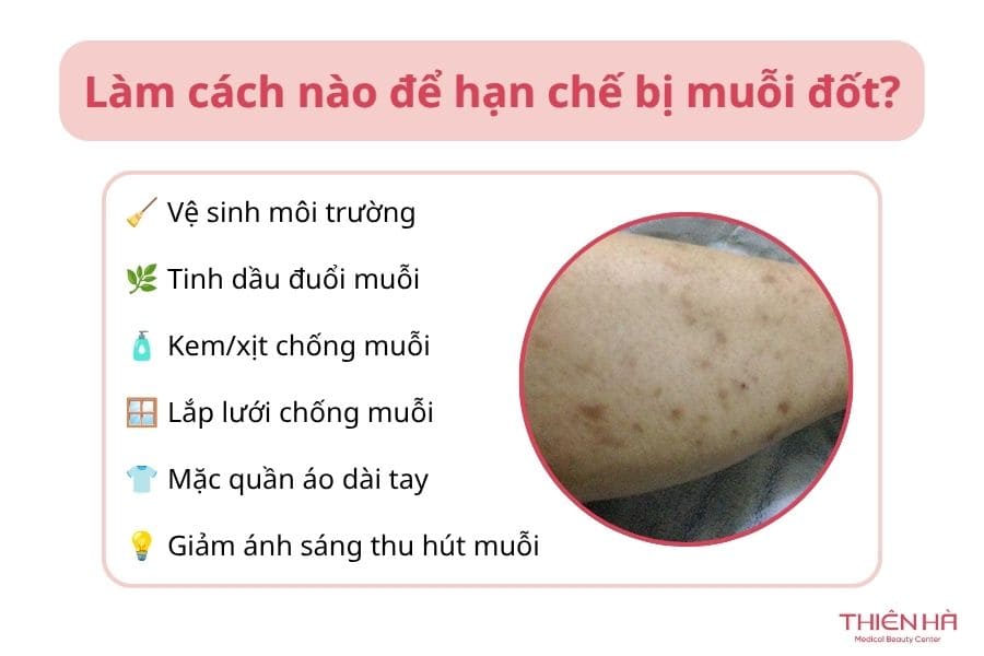 Làm cách nào để hạn chế bị muỗi đốt?