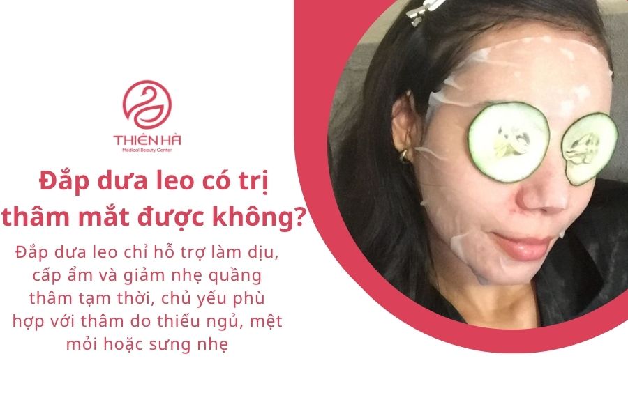 Cách đắp dưa leo trị thâm mắt đơn giản trong 15 phút 1 Cách đắp dưa leo trị thâm mắt chỉ dùng để hỗ trợ làm dịu, cấp ẩm và giảm nhẹ quầng thâm tạm thời, chủ yếu phù hợp với thâm do thiếu ngủ, mệt mỏi hoặc sưng nhẹ