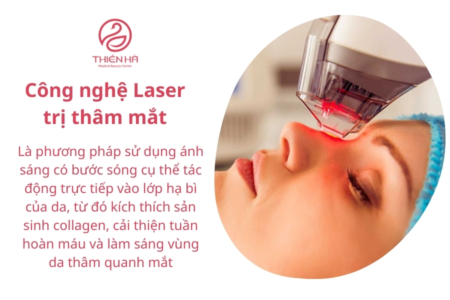 Điều trị thâm mắt bằng công nghệ laser hiện đại.