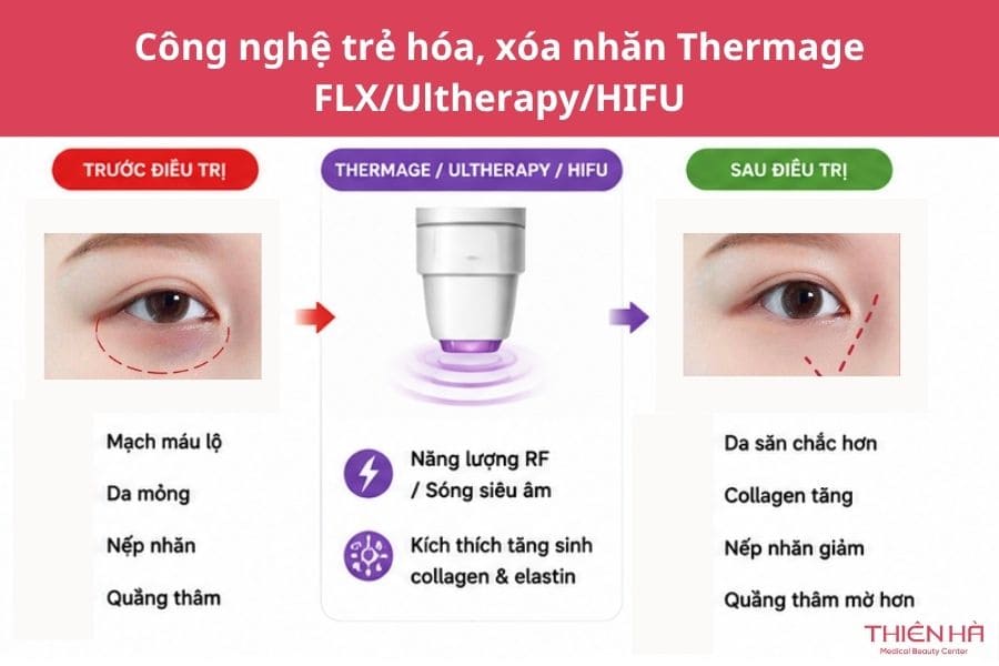 Công nghệ trị thâm mắt nào hiệu quả? Cách lựa chọn phù hợp 4 Công nghệ trẻ hóa, xóa nhăn Thermage FLX/Ultherapy/HIFU