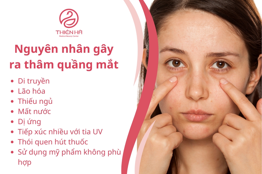 Các nguyên nhân phổ biến gây ra thâm quầng mắt