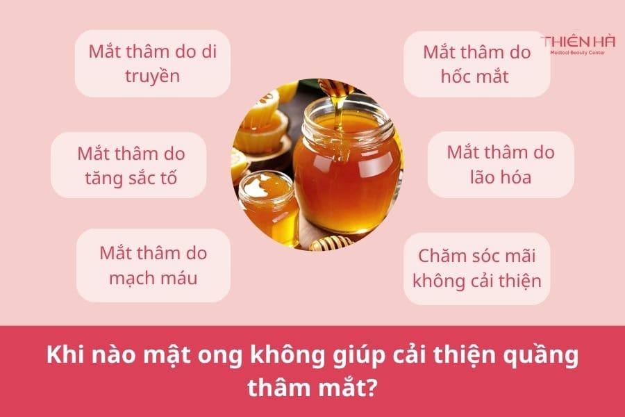 Khi nào mật ong không giúp cải thiện quầng thâm mắt?