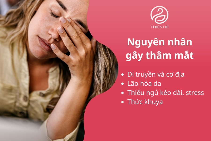 Các tác nhân chính khiến mắt thâm 