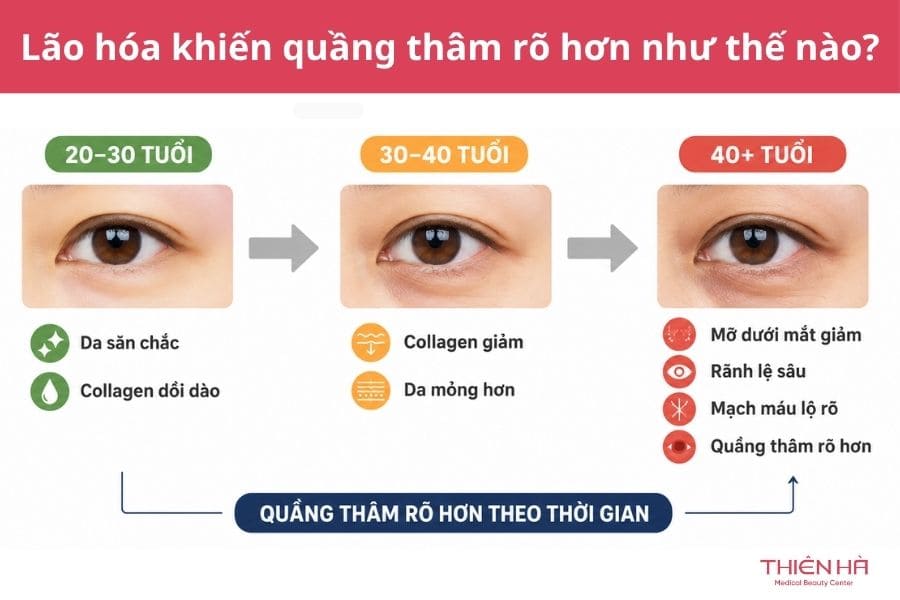 Mắt thâm là gì? Nguyên nhân, dấu hiệu và cách cải thiện hiệu quả 4 Quá trình lão hóa khiến quầng mắt thâm rõ hơn như thế nào?