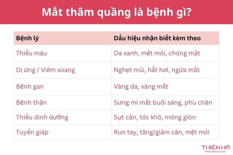 Mắt thâm quầng là bệnh gì? Có phải dấu hiệu cảnh báo bệnh lý? 2 Thâm quầng mắt là bệnh gì?