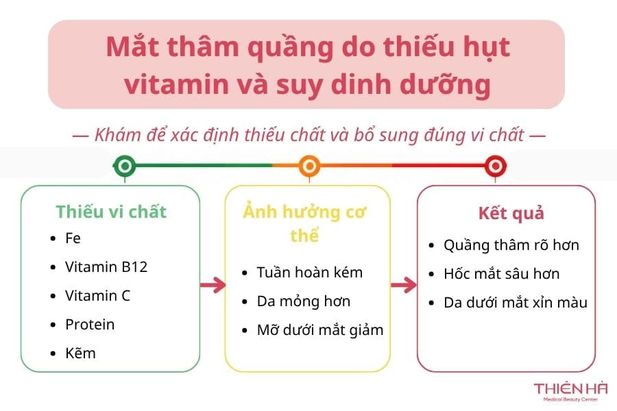 Mắt thâm quầng là bệnh gì? Có phải dấu hiệu cảnh báo bệnh lý? 4 Mắt thâm quầng là bệnh gì: Có thể do cơ thể thiếu hụt vitamin và suy dinh dưỡng, nên đi khám để được bác sĩ chỉ định bổ sung các chất cần thiết