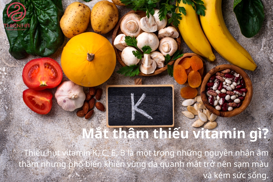 Mắt thâm chủ yếu do thiếu vitamin K, C, E, B