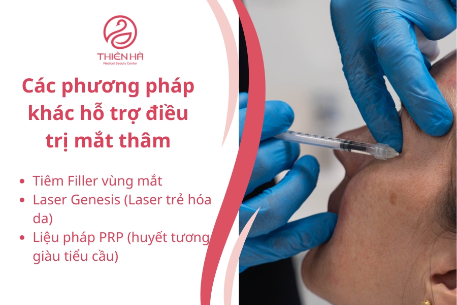 Mắt thâm sẽ được điều trị tốt nhất bằng phương pháp thẩm mỹ công nghệ cao