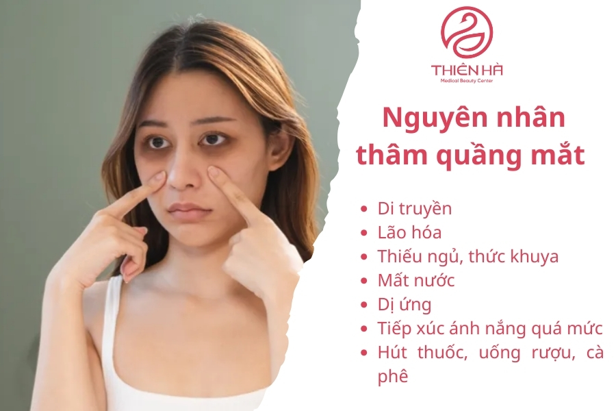 Các nguyên nhân thường gặp gây ra thâm quầng mắt.