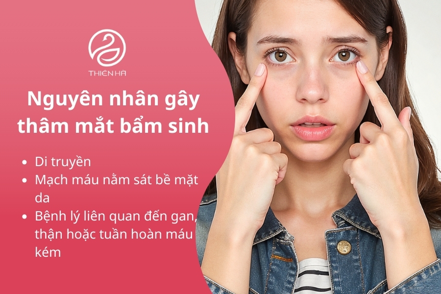 Việc hiểu đúng nguyên nhân gây thâm mắt bẩm sinh là bước đầu tiên quan trọng để lựa chọn phương pháp cải thiện phù hợp và hiệu quả.