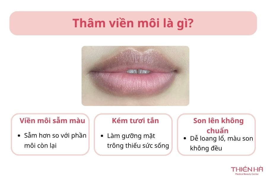 Thâm viền môi: Từ nguyên nhân đến giải pháp 1 Rất nhiều người đã và đang gặp tình trạng thâm viền môi