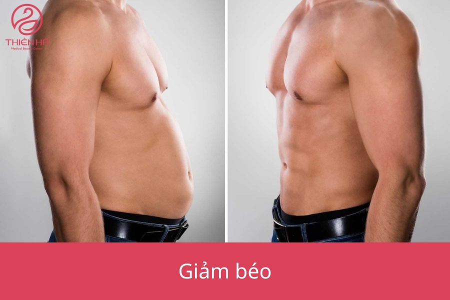 Hình ảnh so sánh vóc dáng trước và sau liệu trình tiêm meso giảm béo, cho thấy sự thay đổi tích cực về số đo các vùng mỡ thừa.