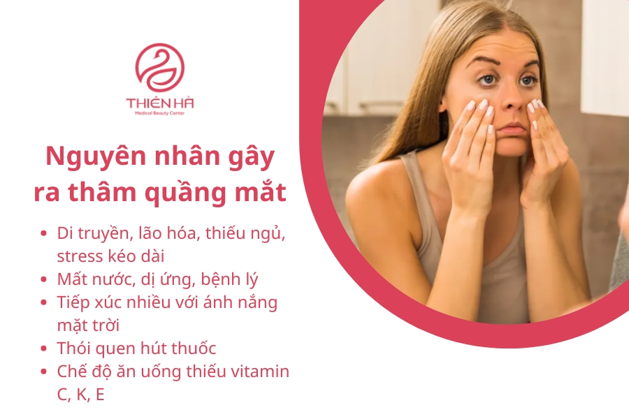 Một vài nguyên nhân nổi bật gây ra thâm quầng dưới mắt 