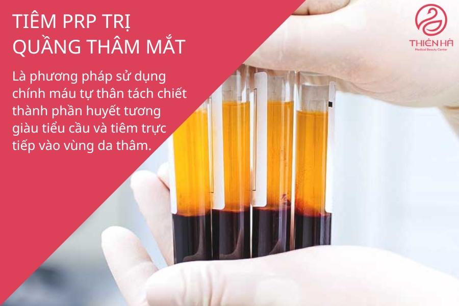 PRP là phương pháp hiệu quả với những người có thâm mắt lâu năm