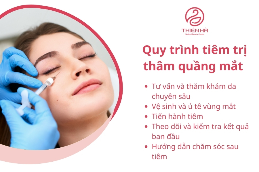 Quy trình tiêm trị thâm quầng mắt tại Thiên Hà