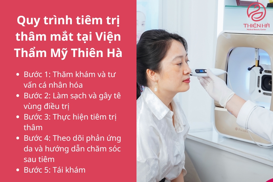 Các bước tiêm trị thâm mắt tại Thiên Hà