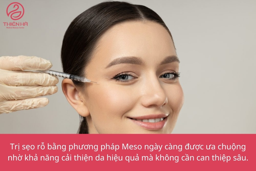 Với những ai tìm kiếm giải pháp hiệu quả, nhẹ nhàng, phục hồi nhanh thì trị sẹo rỗ bằng phương pháp Meso là lựa chọn rất đáng cân nhắc.