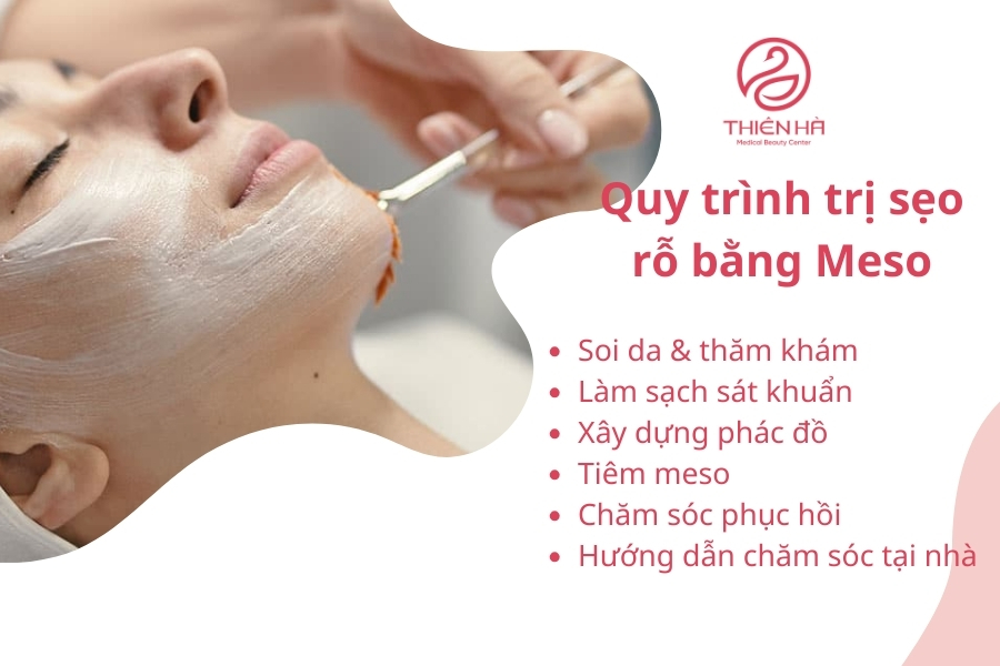 Quy trình trị sẹo rỗ chuẩn y khoa tại Viện thẩm mỹ Thiên Hà