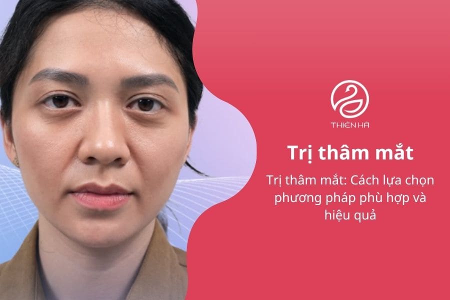 Trị thâm mắt: Cách lựa chọn phương pháp phù hợp và hiệu quả 1 Trị thâm mắt: Cách lựa chọn phương pháp phù hợp và hiệu quả