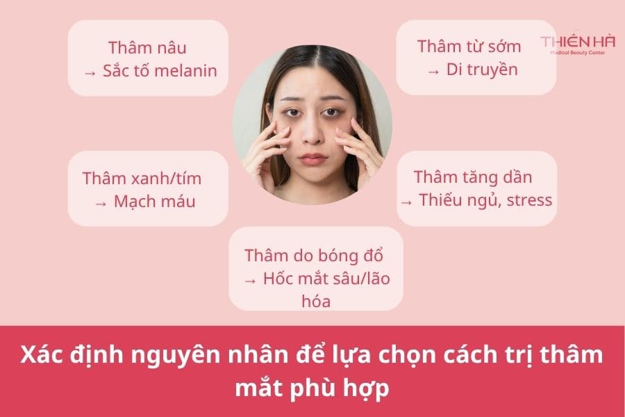 Trị thâm mắt: Cách lựa chọn phương pháp phù hợp và hiệu quả 2 Xác định nguyên nhân để lựa chọn cách trị thâm mắt phù hợp
