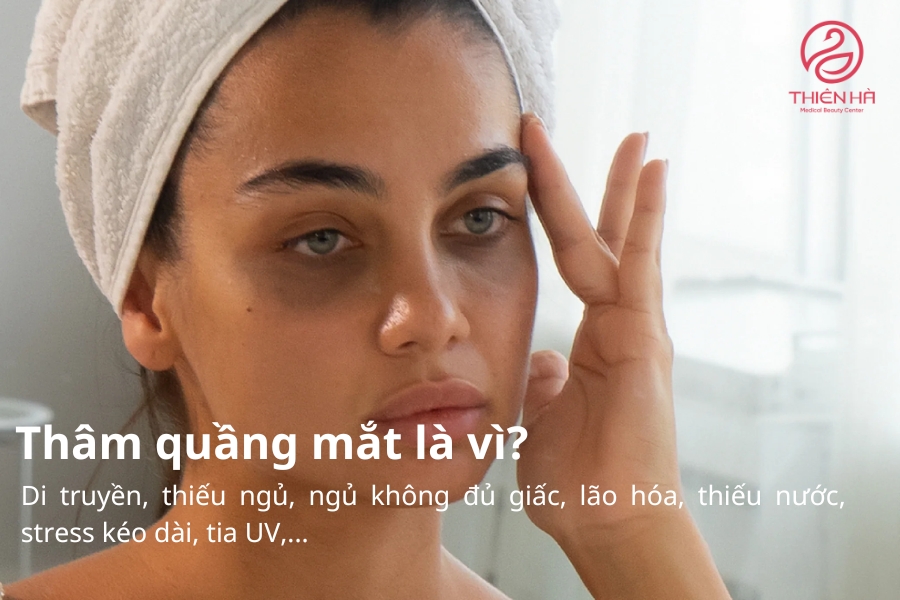 Việc xác định đúng nguyên nhân sẽ giúp bạn lựa chọn phương pháp cải thiện quầng thâm hiệu quả và phù hợp nhất.