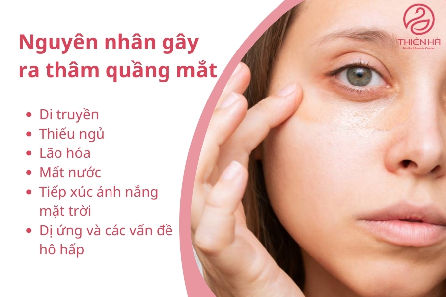Các nguyên nhân chính khiến mắt thâm sạm kém sức sống