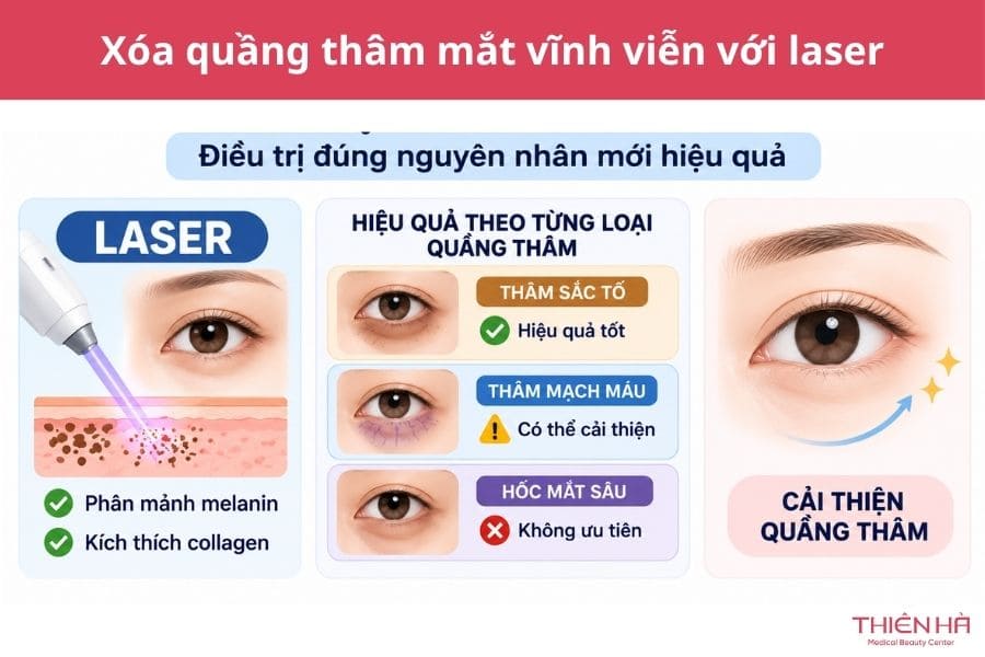 Xóa quầng thâm mắt vĩnh viễn được không? Giải pháp hiệu quả 3 Xóa quầng thâm mắt vĩnh viễn với laser