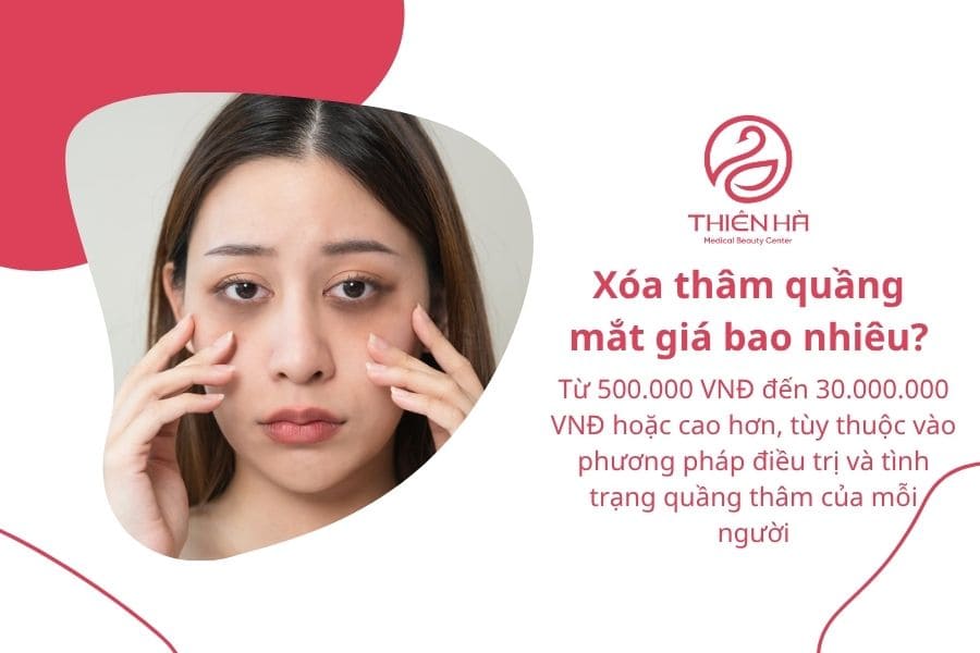 Xóa thâm quầng mắt giá bao nhiêu? Cập nhật bảng giá mới 1 Xóa thâm quầng mắt giá bao nhiêu?