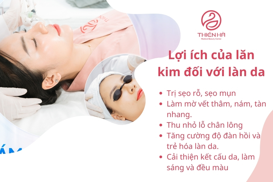 Lợi ích của lăn kim đối với làn da