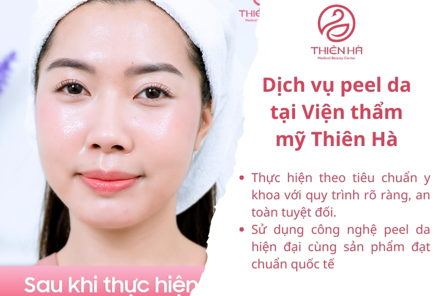 Dịch vụ peel da tại Viện thẩm mỹ Thiên Hà