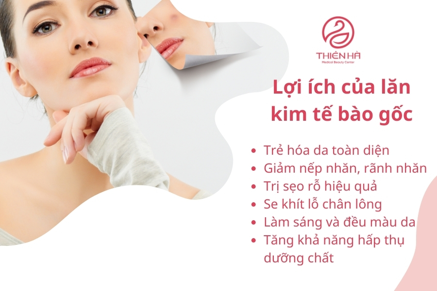 Lợi ích của lăn kim tế bào gốc