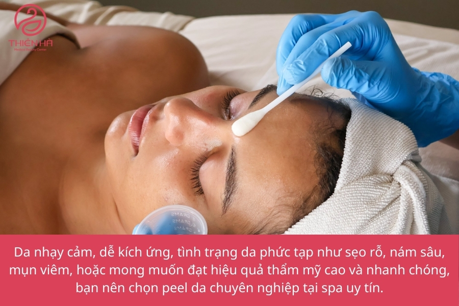 Khi Nào Nên Đến Spa Để Peel Da