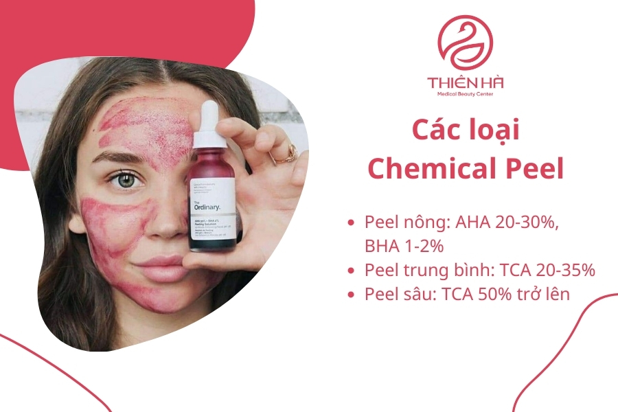Các loại Chemical Peel phổ biến
