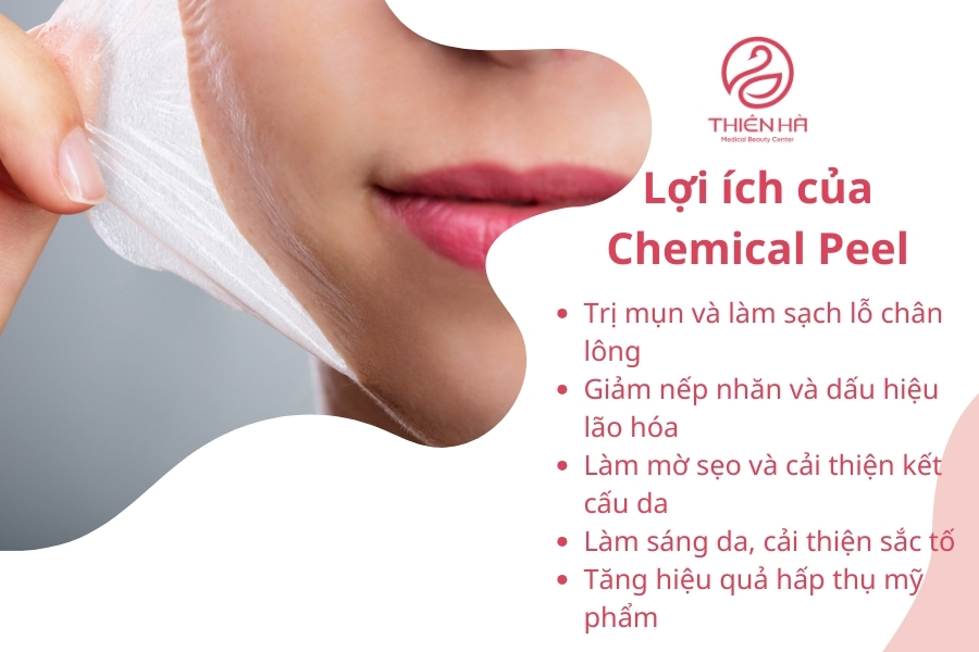  Lợi ích của Chemical Peel