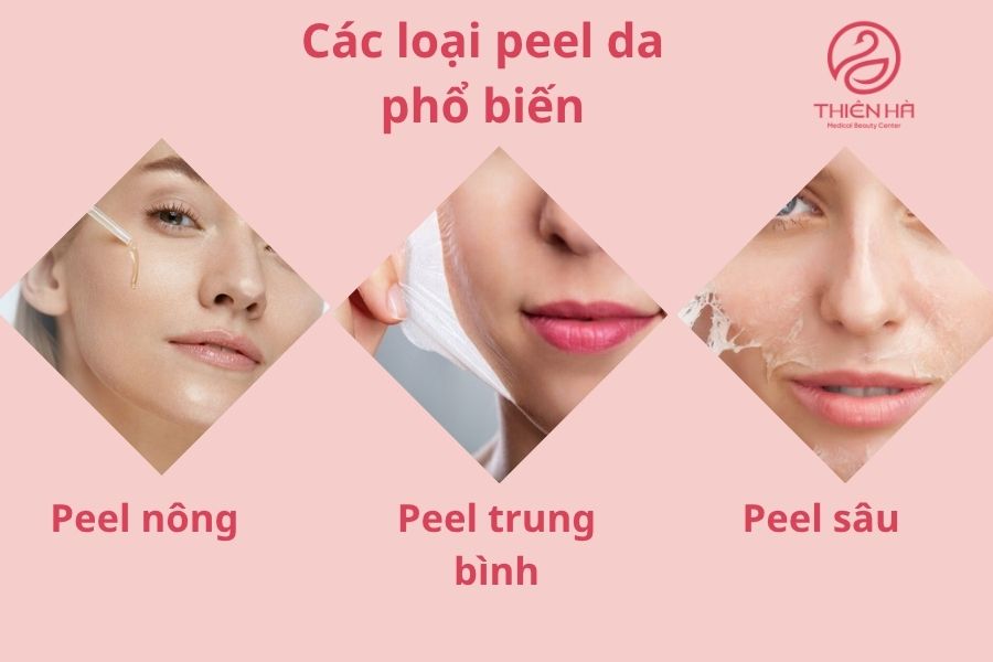 Các loại peel da phổ biến