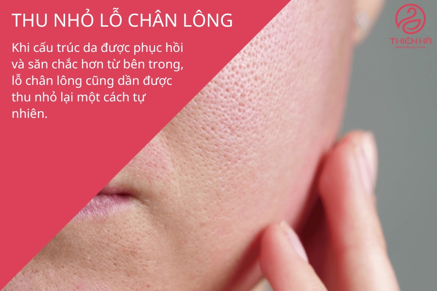 Thu nhỏ lỗ chân lông