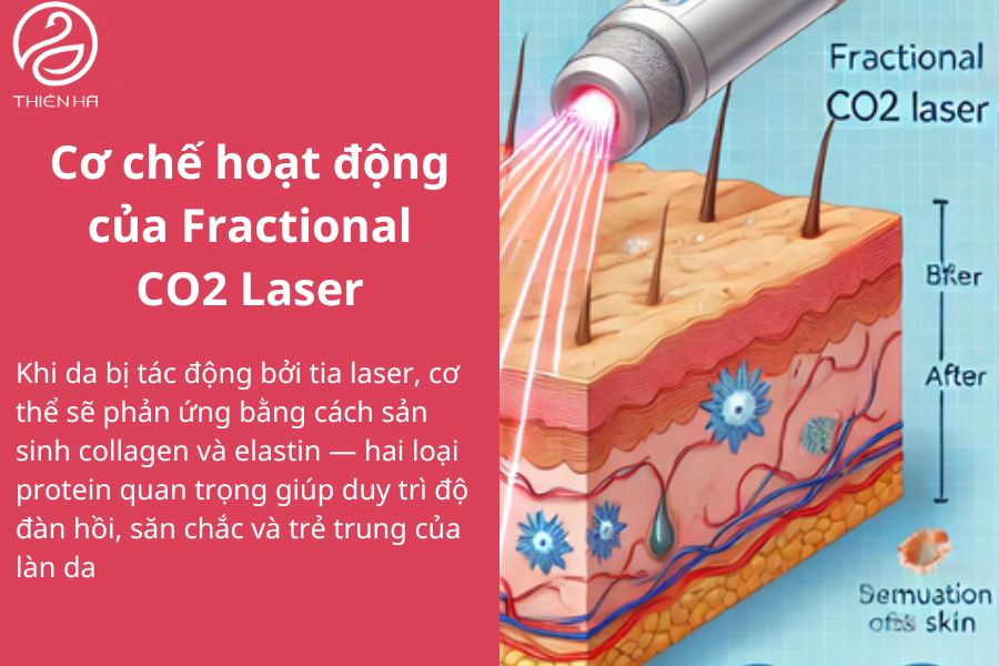 Cơ chế hoạt động của Fractional CO2 Laser