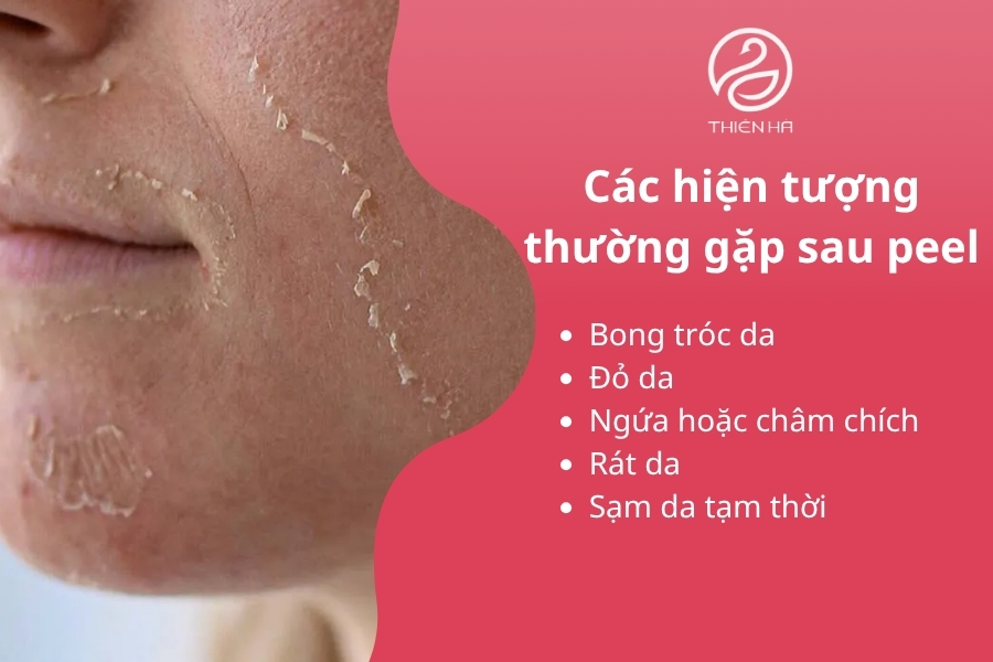 Các Hiện Tượng Thường Gặp Sau Khi Peel Da