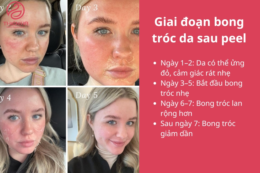 Giai Đoạn Bong Tróc
