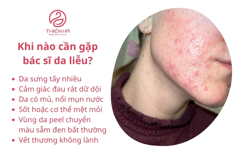 Khi Nào Cần Gặp Bác Sĩ Da Liễu?