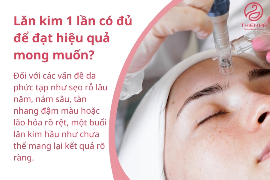 Lăn kim 1 lần có đủ để đạt hiệu quả mong muốn
