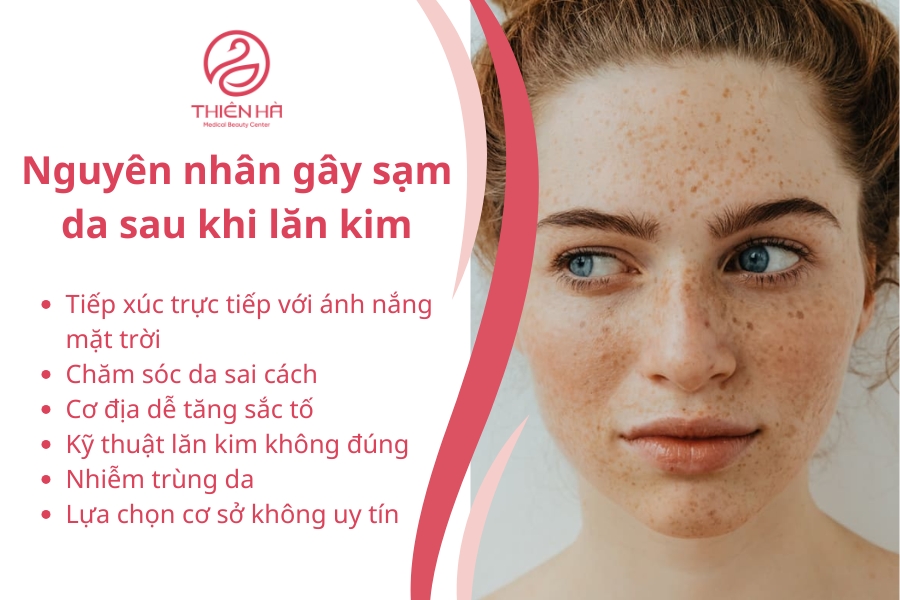  Nguyên nhân gây sạm da sau khi lăn kim